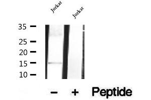 Western blot analysis of extracts of Jurkat cells, using SH2D1B antibody. (SH2D1B 抗体  (Internal Region))