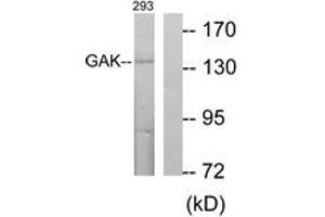 Western blot analysis of extracts from 293 cells, using GAK Antibody. (GAK 抗体  (AA 101-150))