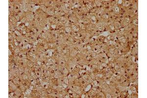 Immunohistochemistry (IHC) image for anti-Phosphatidylinositol-5-Phosphate 4-Kinase, Type II, gamma (PIP4K2C) (AA 127-408) antibody (ABIN7163202)