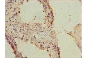 Immunohistochemistry (IHC) image for anti-Feline Leukemia Virus Subgroup C Cellular Receptor Family, Member 2 (FLVCR2) (AA 1-100) antibody (ABIN7152675)