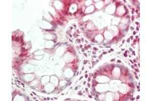 Human Colon: Formalin-Fixed, Paraffin-Embedded (FFPE).