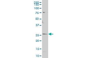 CDC42EP3 polyclonal antibody (A01), Lot # 060509JCS1 Western Blot analysis of CDC42EP3 expression in K-562 . (CDC42EP3 抗体  (AA 42-108))