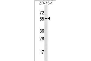 TCN1 Antibody (C-term) (ABIN1537288 and ABIN2838197) western blot analysis in ZR-75-1 cell line lysates (35 μg/lane). (TCN1 抗体  (C-Term))
