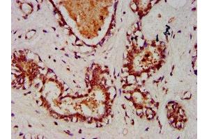 Immunohistochemistry (IHC) image for anti-ADP-Ribosyltransferase 5 (ART5) (AA 45-291) antibody (ABIN7151354)