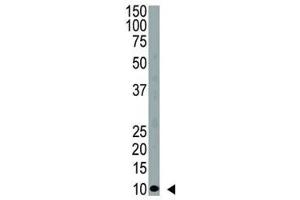 Western blot analysis of anti-Ubiquitin antibody and HeLa cell lysate (Ubiquitin 抗体  (AA 1-32))