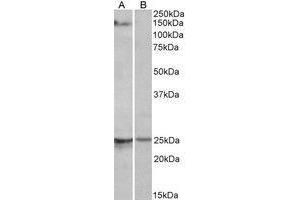 AP22405PU-N RBM20 antibody staining of Mouse Heart lysate at 1 µg/ml (35µg protein in RIPA buffer) with (B) and without (A) blocking with the immunising peptide. (RBM20 抗体  (AA 717-727))