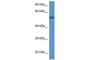WB Suggested Anti-GBA  Antibody Titration: 1 µg/mL  Positive Control: MDA-MB-435S cell lysate  GBA is strongly supported by BioGPS gene expression data to be expressed in Human MDA-MB435 cells