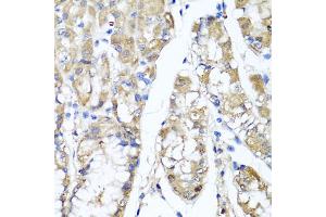 Immunohistochemistry of paraffin-embedded human stomach using TNFAIP6 antibody.