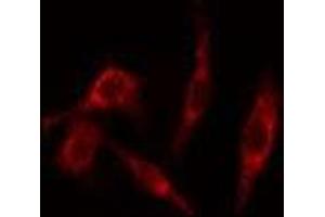 ABIN6277658 staining HeLa cells by IF/ICC. (TK1 抗体  (N-Term))