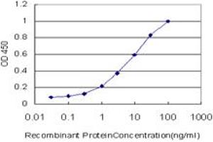 Detection limit for recombinant GST tagged EGR1 is approximately 0. (EGR1 抗体  (AA 444-543))