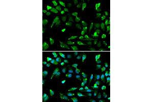 Immunofluorescence analysis of A549 cell using SATB1 antibody. (SATB1 抗体)