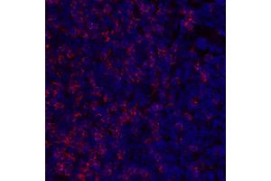 Immunofluorescence (IF) image for anti-CD8a Molecule (CD8A) (C-Term), (Cytoplasmic Domain) antibody (ABIN7449043) (CD8 alpha 抗体  (C-Term, Cytoplasmic Domain))