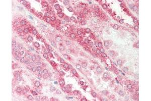 Human Kidney: Formalin-Fixed, Paraffin-Embedded (FFPE).