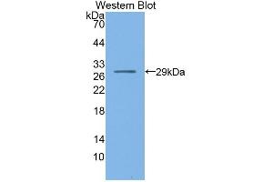 Detection of Recombinant NR0B1, Mouse using Polyclonal Antibody to Nuclear Receptor Subfamily 0, Group B, Member 1 (NR0B1)