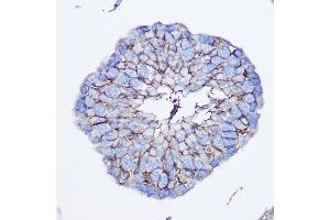 Immunohistochemistry (IHC) image for anti-Chromosome 6 Open Reading Frame 150 (C6orf150) (AA 350-522) antibody (ABIN6143590)