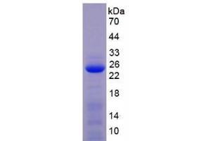 SDS-PAGE analysis of Mouse MMP1 Protein. (MMP1 蛋白)