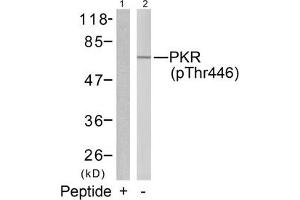 Western blot analysis of extracts from K562 cells using PKR(Phospho-Thr446) Antibody(Lane 2) and the same antibody preincubated with blocking peptide(Lane1).