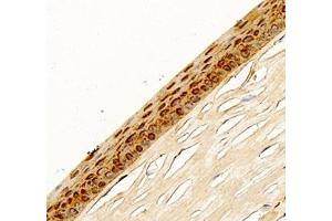 Immunohistochemistry (Paraffin-embedded Sections) (IHC (p)) image for anti-Major Intrinsic Protein of Lens Fiber (MIP) antibody (ABIN7074547)
