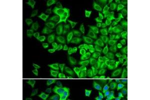 Immunofluorescence analysis of A549 cells using HCK Polyclonal Antibody (HCK 抗体)