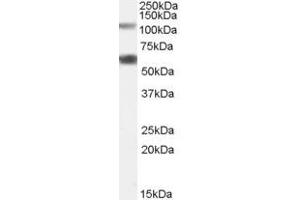 Western Blotting (WB) image for anti-Chromosome 19 Open Reading Frame 66 (C19ORF66) (N-Term) antibody (ABIN2791121) (C19ORF66 抗体  (N-Term))
