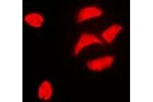 Immunofluorescent analysis of PBOV1 staining in HeLa cells. (PBOV1 抗体)
