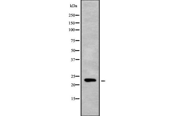 MOBKL2C antibody  (Internal Region)