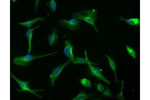 Immunofluorescence staining of U251 cells with ABIN7139735 at 1:100, counter-stained with DAPI. (AXIN2 抗体  (AA 56-73))