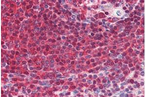 Human Spleen (formalin-fixed, paraffin-embedded) stained with GRB2 antibody ABIN364459 at 5 ug/ml followed by biotinylated anti-mouse IgG secondary antibody ABIN481714, alkaline phosphatase-streptavidin and chromogen. (GRB2 抗体)