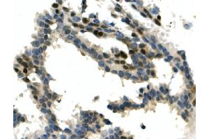 IHC analysis of ITCH/AIP4 using anti-ITCH/AIP4 antibody (ABIN7600264).