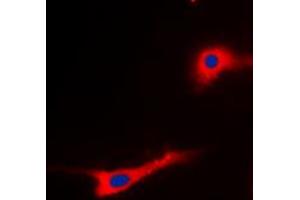 Immunofluorescent analysis of EEF2 (pT56) staining in SKOV3 cells. (EEF2 抗体  (N-Term, pSer56))