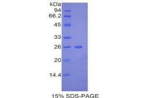 SDS-PAGE (SDS) image for Thyroid Peroxidase (TPO) (AA 19-846) protein (His tag) (ABIN1099513)
