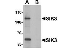 Western blot analysis of SIK3 in rat brain tissue lysate with SIK3 antibody at 1 ug/mL in (A) the absence and (B) the presence of blocking peptide. (SIK3 抗体  (C-Term))