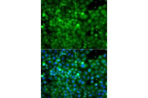 Immunofluorescence analysis of A549 cell using POC1A antibody. (POC1A 抗体)