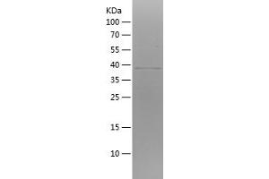 ATP5F1A (AA 186-343) protein (His-IF2DI Tag)