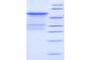 SDS-PAGE (SDS) image for Plasminogen Activator, Urokinase Receptor (PLAUR) (AA 15-211) protein (His tag,GST tag) (ABIN1080531) (PLAUR Protein (AA 15-211) (His tag,GST tag))