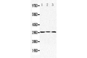 Anti-Apolipoprotein D antibody, Western blotting Lane 1: MCF-7 Cell Lysate Lane 2: HELA Cell Lysate Lane 3: SMMC Cell Lysate (Apolipoprotein D 抗体  (C-Term))