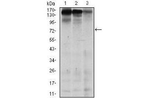 Western blot analysis using MSH6 mouse mAb against MCF-7 (1), HEK293 (2), and HCT116 (3) cell lysate. (MSH6 抗体)