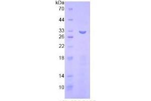 SDS-PAGE analysis of Human ITFG1 Protein. (ITFG1 蛋白)
