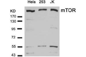 Image no. 1 for anti-Mechanistic Target of Rapamycin (serine/threonine Kinase) (mTOR) (Ser2448) antibody (ABIN319330) (MTOR 抗体  (Ser2448))
