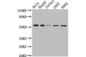 Western Blot Positive WB detected in: Hela whole cell lysate, HepG2 whole cell lysate, Jurkat whole cell lysate, 293T whole cell lysate, K562 whole cell lysate All lanes: MCT1 antibody at 1:1000 Secondary Goat polyclonal to rabbit IgG at 1/50000 dilution Predicted band size: 54, 47 kDa Observed band size: 54 kDa