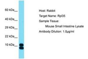 Image no. 1 for anti-Ribosomal Protein L35 (RPL35) (AA 61-110) antibody (ABIN6750520) (RPL35 抗体  (AA 61-110))