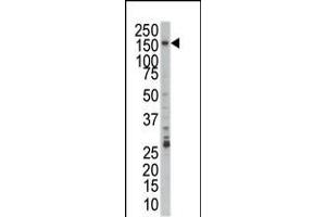 Western blot analysis of anti-PRP4 Pab in Jurkat cell lysate (PRPF4B 抗体  (C-Term))