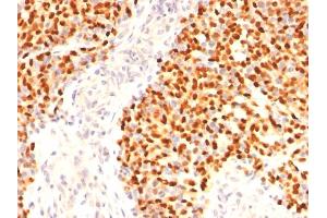 Immunohistochemistry (IHC) image for anti-Myogenin (Myogenic Factor 4) (MYOG) (AA 138-158), (AA 30-224), (AA 73-94) antibody (ABIN6940163)