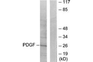 Western blot analysis of extracts from NIH-3T3 cells, using PDGFB Antibody. (PDGFB 抗体  (AA 16-65))
