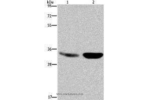 Western blot analysis of Human fetal brain and mouse brain tissue, using MAPRE3 Polyclonal Antibody at dilution of 1:500 (MAPRE3 抗体)
