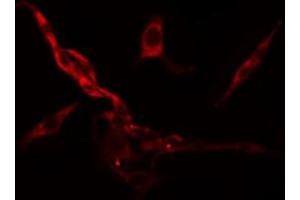 ABIN6274484 staining Hela cells by IF/ICC. (RPS6KC1 抗体  (Internal Region))