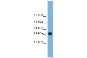 POP5 antibody used at 1 ug/ml to detect target protein. (POP5 抗体)