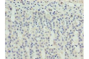 Immunohistochemistry of paraffin-embedded human adrenal gland tissue using ABIN7176155 at dilution of 1:100 (ZNF215 抗体  (AA 12-304))
