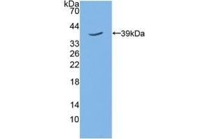 TPBG 抗体  (AA 34-356)