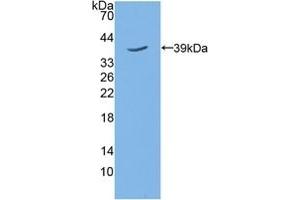 Detection of Recombinant TPBG, Mouse using Polyclonal Antibody to 5T4 (TPBG 抗体  (AA 34-356))